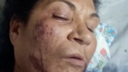 Info Martí | Madre de preso político se recupera de asalto y golpiza en la vía pública