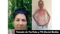 Moraima Rodríguez Batista denunció que le robaron los alimentos de su hijo el prisionero político enfermo de cáncer Alexander Díaz Rodríguez.