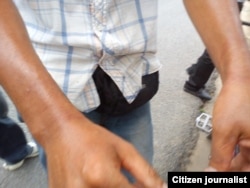 Activista marcas esposas foto Yelky Puig